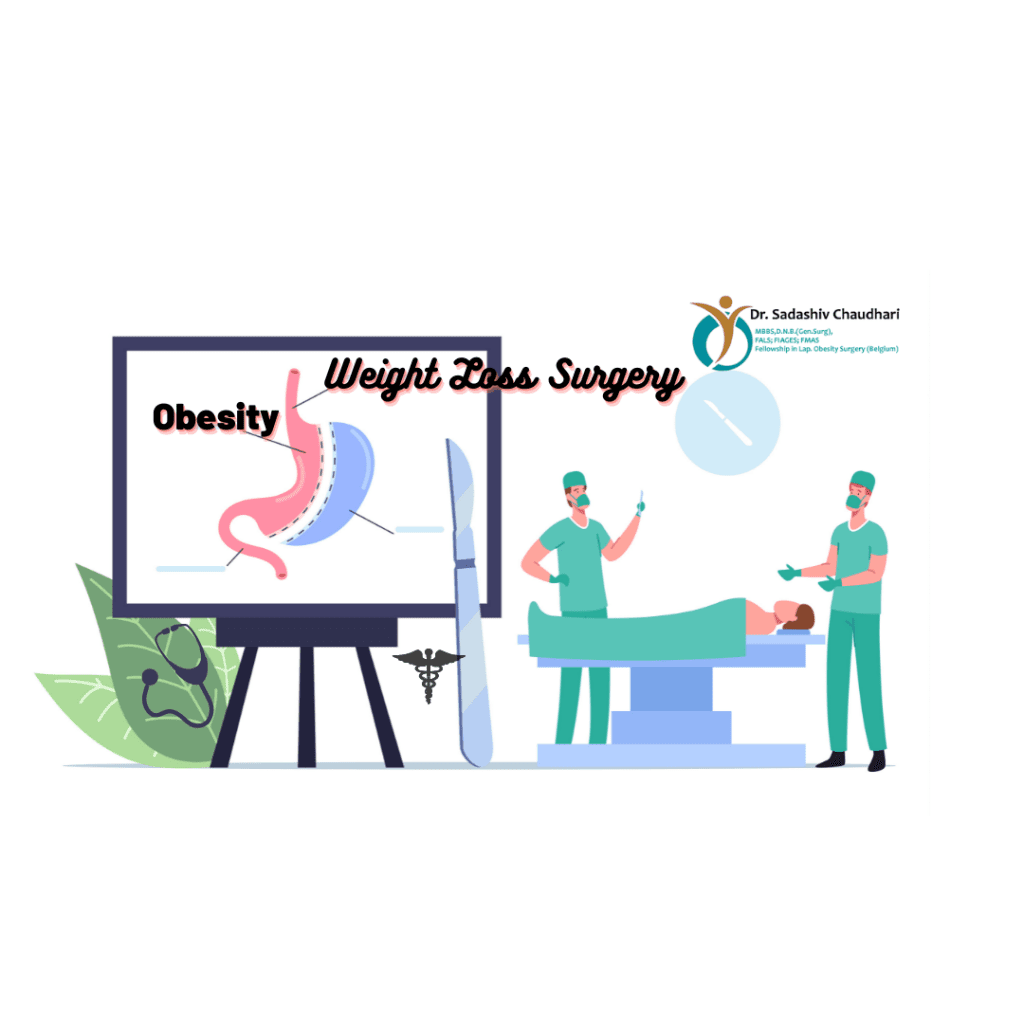 Weight loss surgery