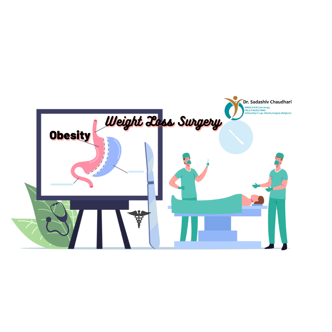 Bariatric Surgery in Mumbai